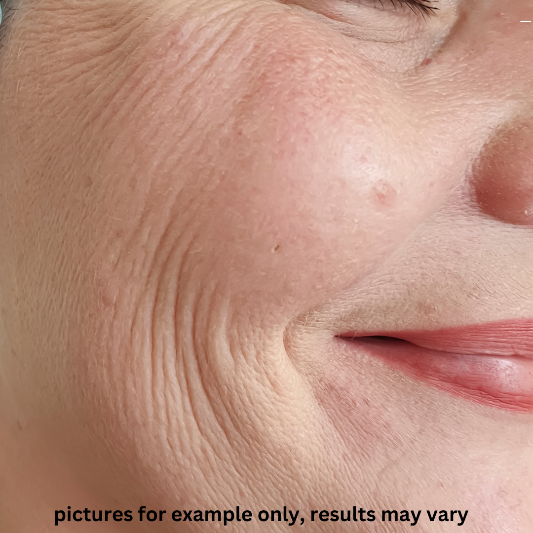 Moana Signature Facial — Before