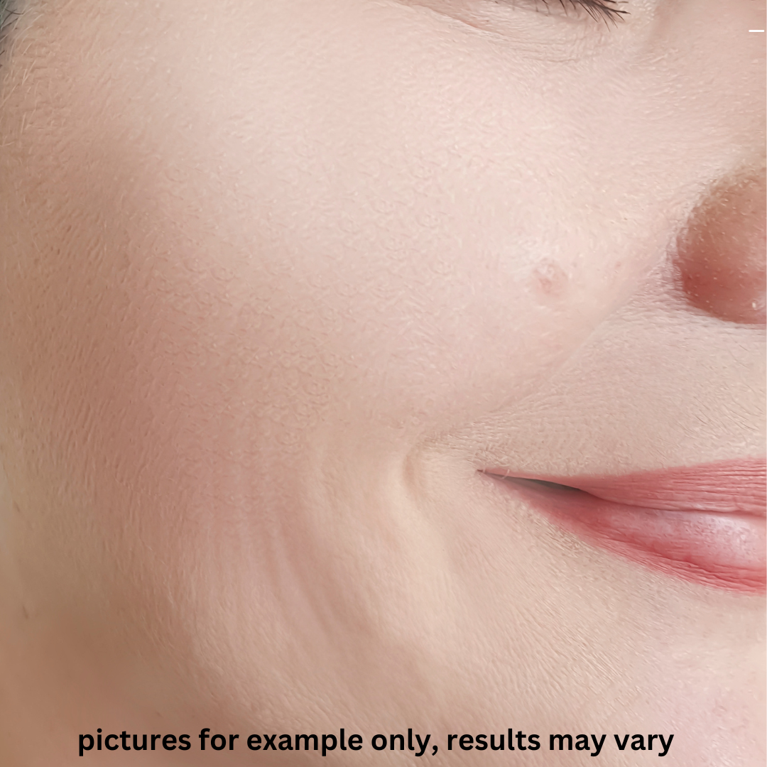 Moana Signature Facial — After