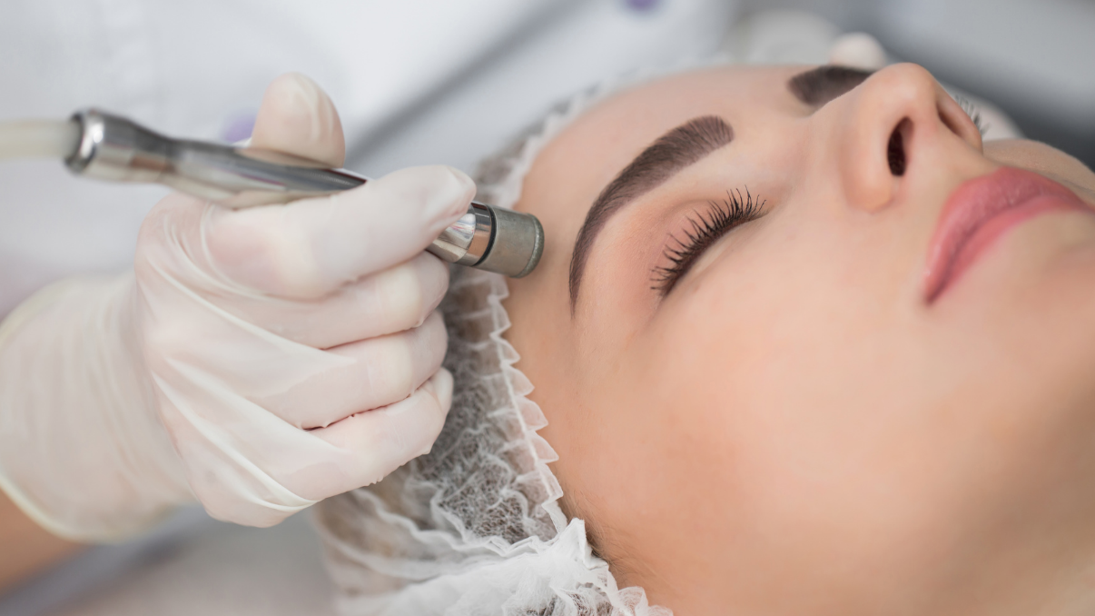 Microdermabrasion