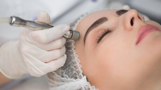 Microdermabrasion